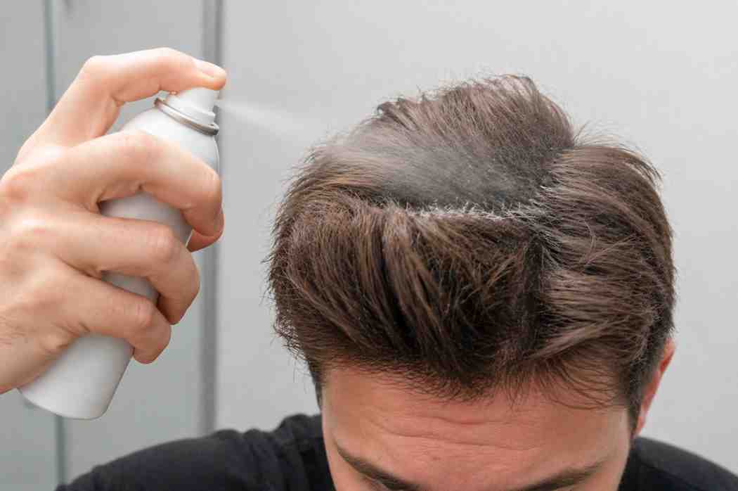 Hand spraying dry shampoo onto hair dent area
on top of head to restore volume